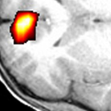  PhD Program in Neuroscience at Wake Forest School of Medicine